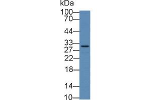 Western blot analysis of Human Liver lysate, using Mouse NF2 Antibody (2 µg/ml) and HRP-conjugated Goat Anti-Rabbit antibody ( (Merlin Antikörper  (AA 30-311))