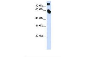 Image no. 1 for anti-TSC22 Domain Family, Member 2 (TSC22D2) (AA 614-663) antibody (ABIN6737731) (TSC22D2 Antikörper  (AA 614-663))