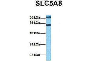 Host:  Rabbit  Target Name:  SLC5A8  Sample Tissue:  Human OVCAR-3  Antibody Dilution:  1. (SLC5A8 Antikörper  (Middle Region))