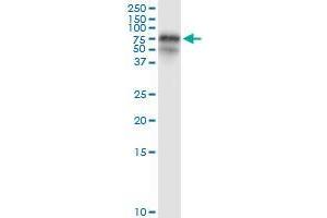 Immunoprecipitation of FGL2 transfected lysate using rabbit polyclonal anti-FGL2 and Protein A Magnetic Bead (FGL2 (Human) IP-WB Antibody Pair)