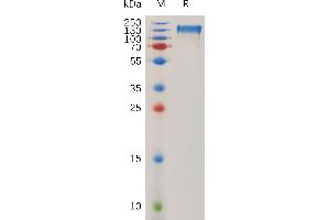 CD51 Protein (AA 31-992) (Fc-His Tag)