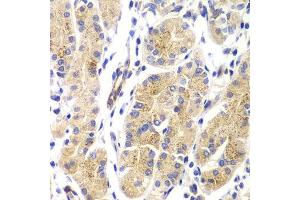 Immunohistochemistry of paraffin-embedded human gastric using HRAS antibody. (HRAS Antikörper)