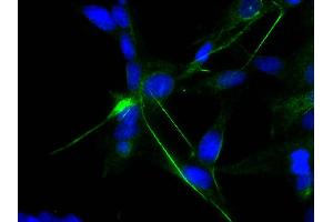 Human astrocytoma cell line CCF-STTG1 was stained with Mouse Anti-Human GFAP-UNLB and DAPI. (GFAP Antikörper)