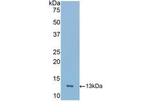 Detection of Recombinant ICOS, Mouse using Polyclonal Antibody to Inducible T-Cell Co Stimulator (ICOS) (ICOS Antikörper  (AA 35-131))