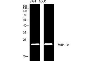 Western blot analysis of 293T COLO using MRP-L35 antibody. (MRPL35 Antikörper  (AA 80-160))