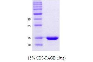 Figure annotation denotes ug of protein loaded and % gel used. (alpha Synuclein DeltaNAC (active) Protein)