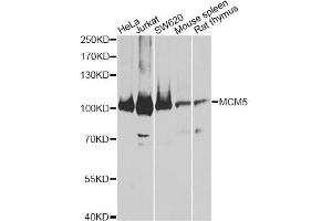 Western blot analysis of extracts of various cell lines, using MCM5 antibody. (MCM5 Antikörper)