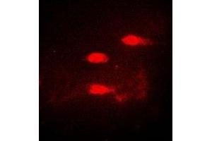 Immunofluorescent analysis of CALCOCO1 staining in A549 cells. (CALCOCO1 Antikörper)