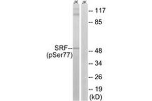 Western blot analysis of extracts from Jurkat cells treated with PMA 125ng/ml 30', using SRF (Phospho-Ser77) Antibody. (SRF Antikörper  (pSer77))