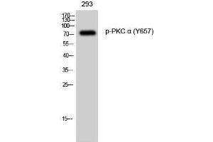 Western Blotting (WB) image for anti-Protein Kinase C, alpha (PKCa) (pTyr657) antibody (ABIN3179536) (PKC alpha Antikörper  (pTyr657))