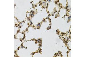 Immunohistochemistry of paraffin-embedded rat lung using IFI16 Antibody (ABIN6291165) at dilution of 1:100 (40x lens). (IFI16 Antikörper)