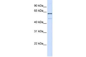 Western Blotting (WB) image for anti-Methyltransferase Like 16 (METTL16) antibody (ABIN2459138) (METTL16 Antikörper)