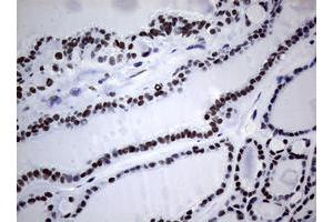 Image no. 1 for anti-Nibrin (NBN) (AA 183-460) antibody (ABIN1491056) (Nibrin Antikörper  (AA 183-460))