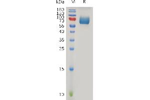 Human IF Protein, hFc Tag on SDS-PAGE under reducing condition. (IFNAR2 Protein (AA 27-243) (Fc Tag))