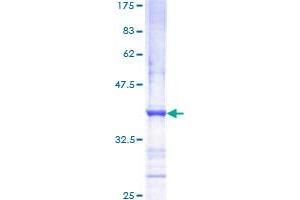 Image no. 1 for Met Proto-Oncogene (MET) (AA 26-125) protein (GST tag) (ABIN1310735) (c-MET Protein (AA 26-125) (GST tag))