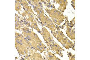 Immunohistochemistry of paraffin-embedded human stomach using PPP2CA antibody (ABIN5974047) at dilution of 1/100 (40x lens). (PPP2CA Antikörper)