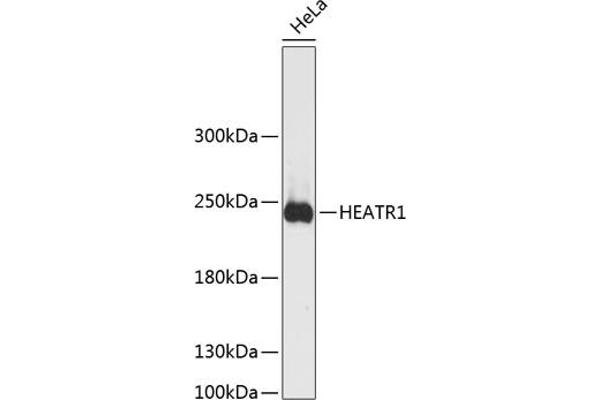 HEATR1 Antikörper  (AA 1-120)