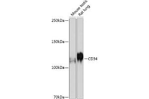 Western blot analysis of extracts of various cell lines, using CD34 antibody (ABIN7266187) at 1:500 dilution. (CD34 Antikörper)