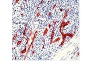 Formalin fixed paraffin embedded human tonsil stained with Factor VIII R antigen polyclonal  rabbit antibody (VWF Antikörper)