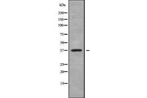 Western blot analysis of TCF19 using NIH-3T3 whole cell lysates (TCF19 Antikörper  (Internal Region))