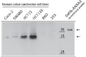 Western Blotting (WB) image for anti-Annexin A3 (ANXA3) antibody (ABIN2703592) (Annexin A3 Antikörper)