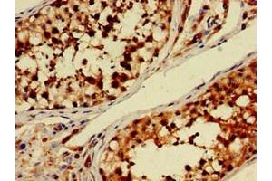 Immunohistochemistry of paraffin-embedded human testis tissue using ABIN7150681 at dilution of 1:100 (PDE11A Antikörper  (AA 42-190))