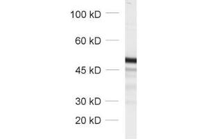 dilution: 1 : 1000, sample: total cell lysate from fibroblasts transfected with a GFP fusion construct (GFP Antikörper)