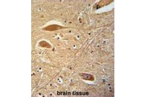 Immunohistochemistry (IHC) image for anti-Fibrinogen beta Chain (FGB) antibody (ABIN3002657) (Fibrinogen beta Chain Antikörper)