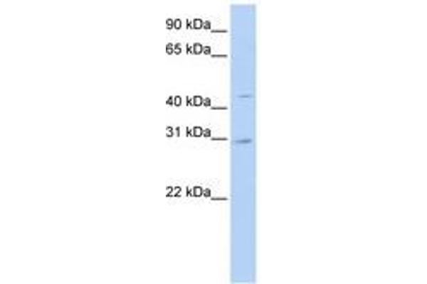 SLC10A4 Antikörper  (N-Term)