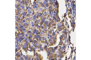 Immunohistochemistry (IHC) image for anti-Ribosomal Protein L5 (RPL5) antibody (ABIN1874650) (RPL5 Antikörper)