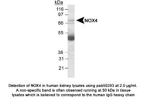 Image no. 1 for anti-NADPH Oxidase 4 (NOX4) (AA 100-200) antibody (ABIN363602) (NADPH Oxidase 4 Antikörper  (AA 100-200))