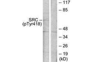 Western blot analysis of extracts from COLO205 cells treated with serum 15% 10', using Src (Phospho-Tyr418) Antibody. (Src Antikörper  (pTyr419))