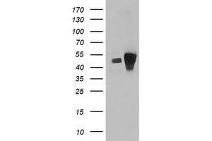 Western Blotting (WB) image for anti-ADP-Ribosylation Factor GTPase Activating Protein 1 (ARFGAP1) antibody (ABIN1496680) (ARFGAP1 Antikörper)