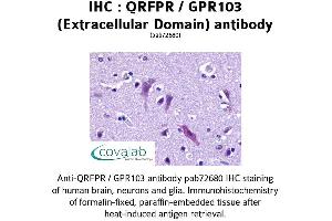 Image no. 1 for anti-Pyroglutamylated RFamide Peptide Receptor (QRFPR) (2nd Extracellular Domain) antibody (ABIN1738665) (QRFPR Antikörper  (2nd Extracellular Domain))