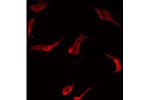 ABIN6275473 staining HT29 by IF/ICC. (RAB7L1 Antikörper  (Internal Region))