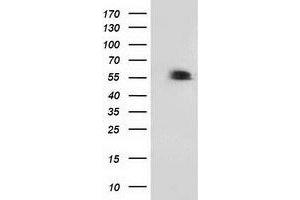 Western Blotting (WB) image for anti-Tumor Protein P53 (TP53) antibody (ABIN1499977) (p53 Antikörper)
