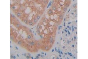 IHC-P analysis of Human Tissue, with DAB staining. (SAT1 Antikörper  (AA 1-171))