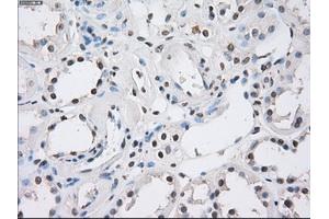 Immunohistochemistry (IHC) image for anti-Fc Fragment of IgG, Low Affinity IIa, Receptor (CD32) (FCGR2A) antibody (ABIN1497262) (FCGR2A Antikörper)