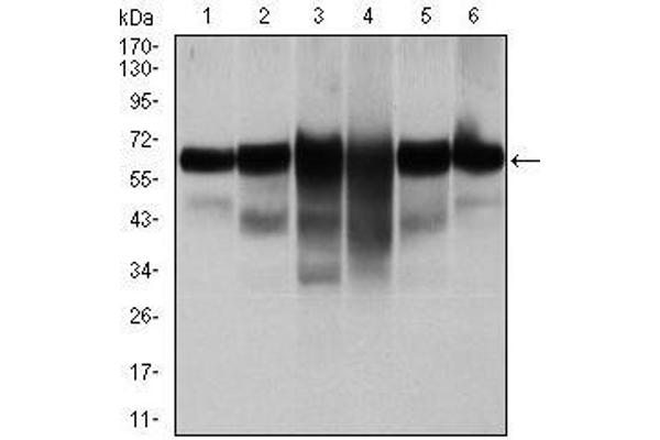 Cytokeratin 5 Antikörper