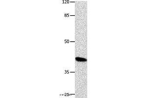Western blot analysis of K562 cell, using POU5F1 Polyclonal Antibody at dilution of 1:500 (OCT4 Antikörper)