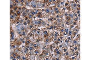 Immunohistochemistry (IHC) image for anti-Potassium Channel Subfamily K Member 1 (KCNK1) antibody (ABIN2423693) (KCNK1 Antikörper)