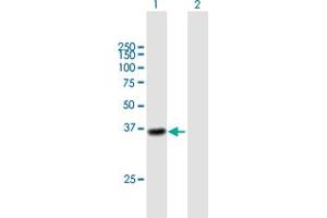 Western Blot analysis of CTSL1 expression in transfected 293T cell line by CTSL1 MaxPab polyclonal antibody. (Cathepsin L Antikörper  (AA 1-333))