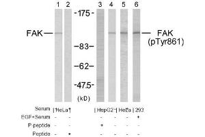 Image no. 2 for anti-PTK2 Protein tyrosine Kinase 2 (PTK2) (Tyr861) antibody (ABIN197234) (FAK Antikörper  (Tyr861))