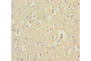 Immunohistochemistry of paraffin-embedded human brain tissue using ABIN7151538 at dilution of 1:100 (EEF1A2 Antikörper  (AA 184-463))