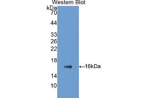 Western blot analysis of the recombinant protein. (GAD Antikörper  (AA 1-97))