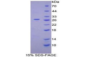 SDS-PAGE analysis of Human Coagulation Factor XII Protein. (F12 Protein)