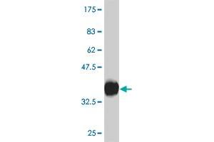 Western Blot detection against Immunogen (30. (CXCR4 Antikörper  (AA 1-46))