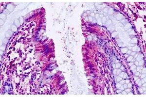 Human, Colon: Formalin-Fixed Paraffin-Embedded (FFPE) (PTGER4 Antikörper  (C-Term))