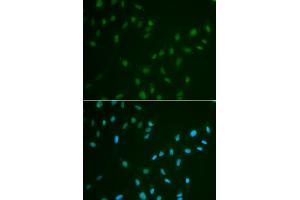 Immunofluorescence analysis of A549 cells using HSF2 antibody. (HSF2 Antikörper)