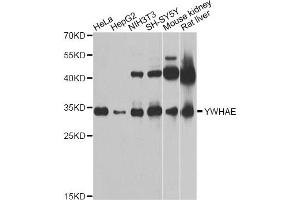 Western blot analysis of extracts of various cell lines, using YWHAE Antibody (ABIN5970417) at 1/1000 dilution. (YWHAE Antikörper)
